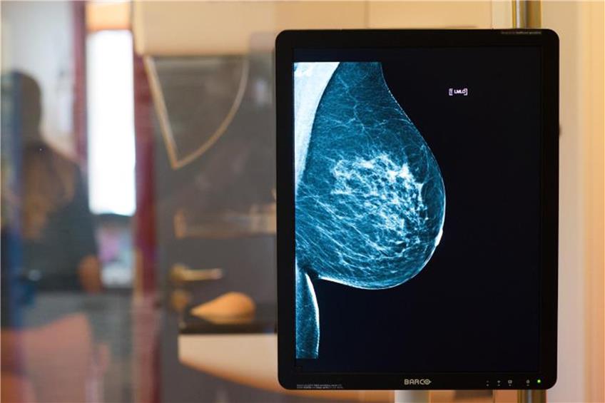 Die gesunde Brust einer Frau ist auf einer Röntgenaufnahme zu sehen. Foto: Klaus-Dietmar Gabbert/Archiv dpa