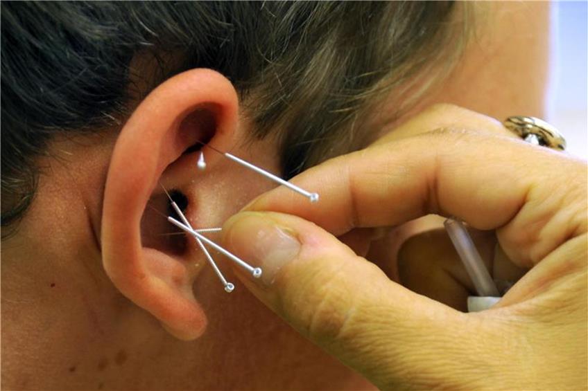 Eine Ärztin bringt Akkupunkturnadeln an dem Ohr eines Patienten an. Foto: Waltraud Grubitzsch/Archiv dpa/lsw